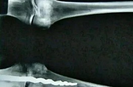 Мумия в калифорнийском музее доказала, что египтяне проводили сложные операции 