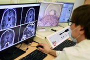 Создана программа для диагностики шизофрении по данным МРТ