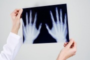 Nature Communications: изучено разрушительное воздействие рентгеновских лучей на кости