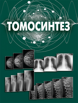 Томосинтез 